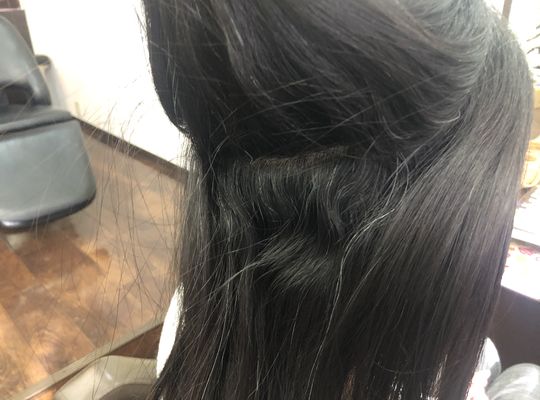 矯正ビフォア