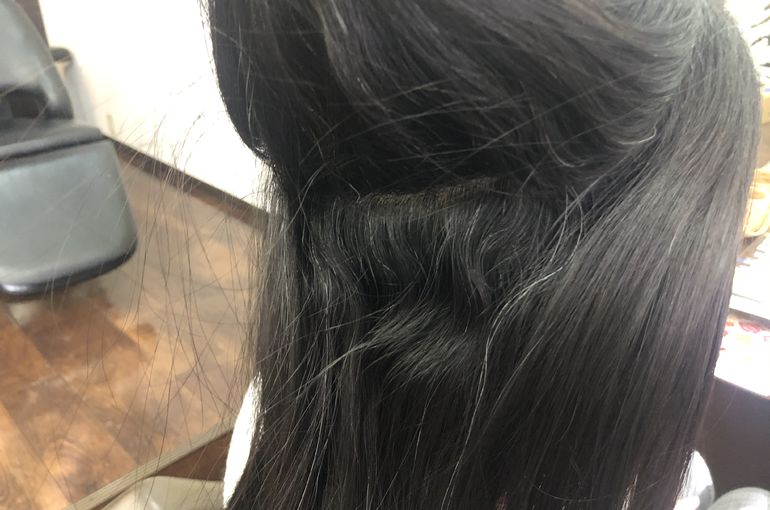 矯正ビフォア